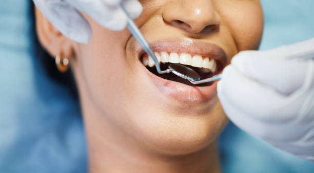 Best Emergency Dental Extractions in North Fork, CA