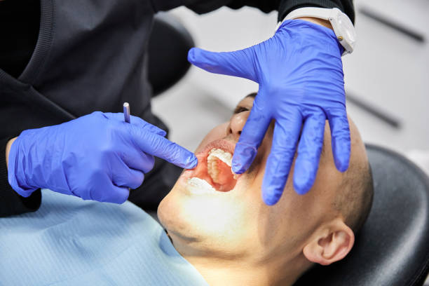 Best Emergency Dentist for Lost Fillings or Crowns in North Fork, CA