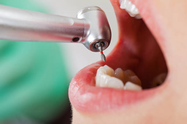 Best Orthodontic Emergency Dentist in North Fork, CA